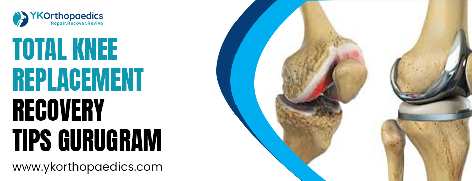 Recover Like a Pro: Total Knee Replacement Recovery Insights for Gurugram Residents