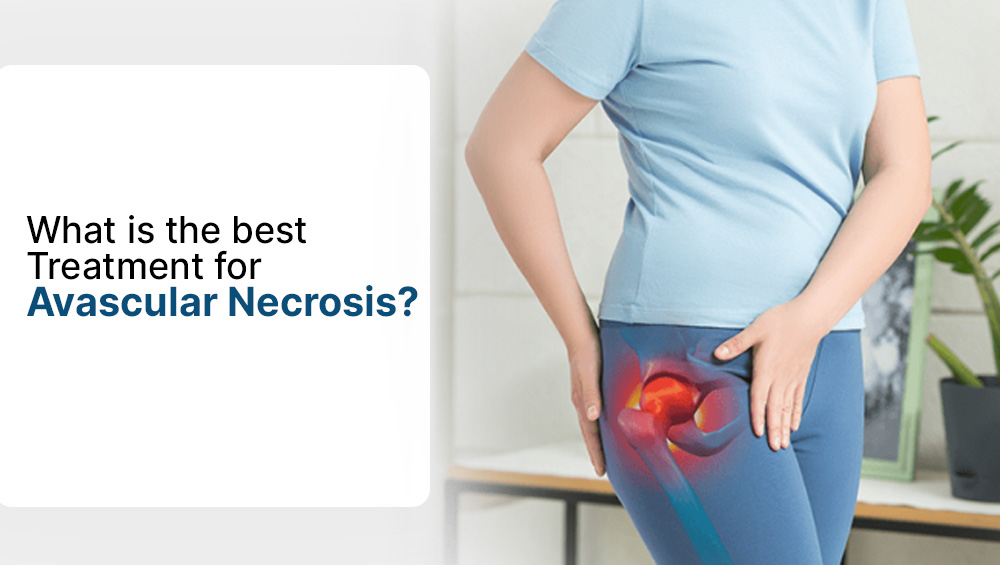 What is the Best Treatment for Avascular Necrosis (AVN)?