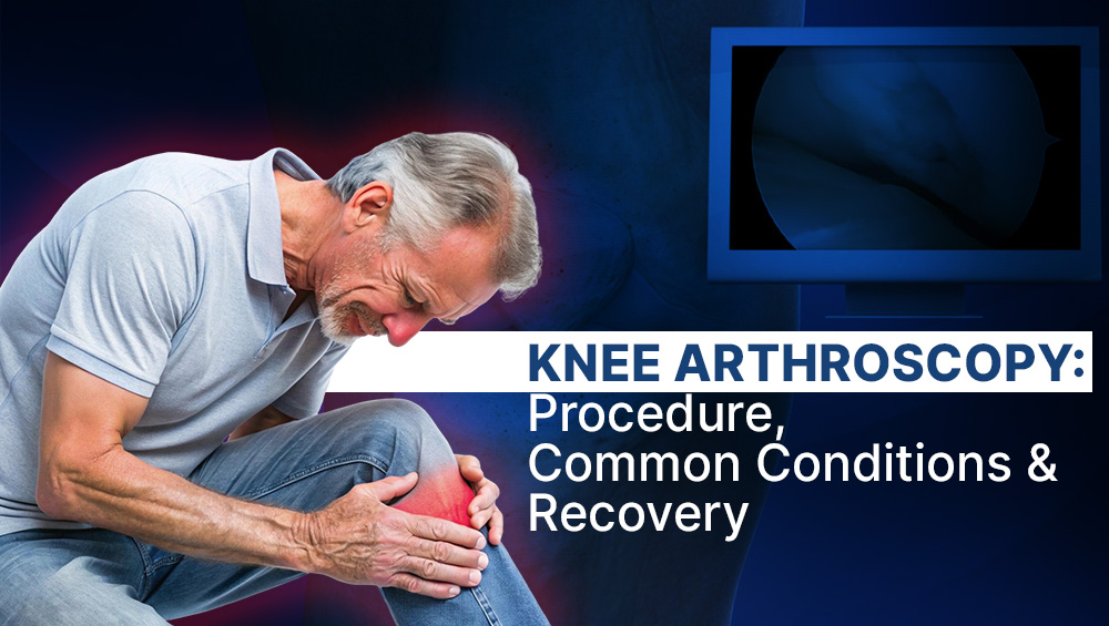What is Knee Arthroscopy: Everything You Need to Know Before You Go