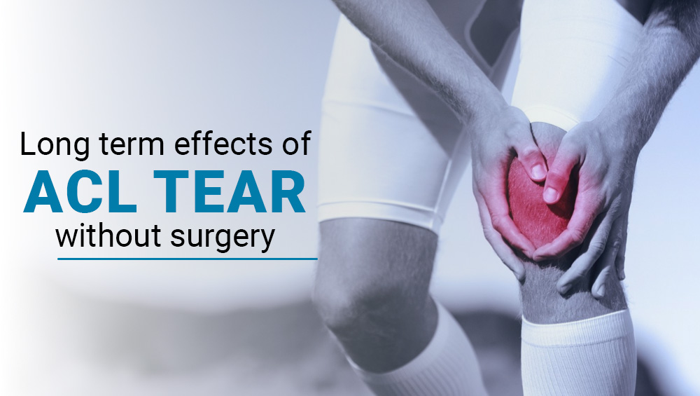 Long-Term Effects of ACL Tear Without Surgery