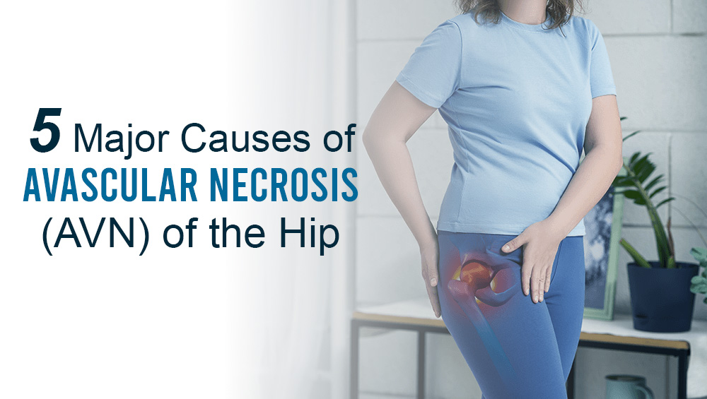 5 Major Causes of Avascular Necrosis (AVN) of the Hip